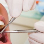 How Dental Care Can Affect Your Overall Health